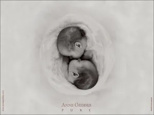 Anne宝贝 第二辑_17