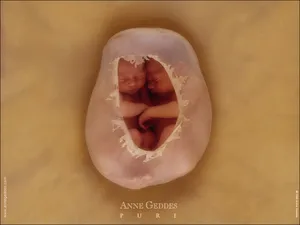 Anne宝贝 第一辑