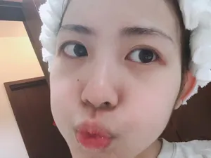 赖美云皮肤水嫩嘟嘴卖萌俏皮可爱自拍图片_2