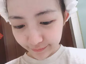 赖美云皮肤水嫩嘟嘴卖萌俏皮可爱自拍图片_3
