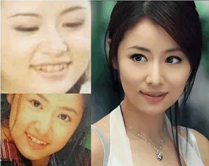 小S高圆圆林心如angelababy女星整容前龅牙丑照曝光第1张